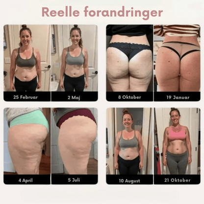SculptLine™ Leggings – Aktiv kompression for glattere hud & forbedret cirkulation