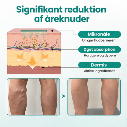 VeinHeal™ – Slip for tunge og trætte ben