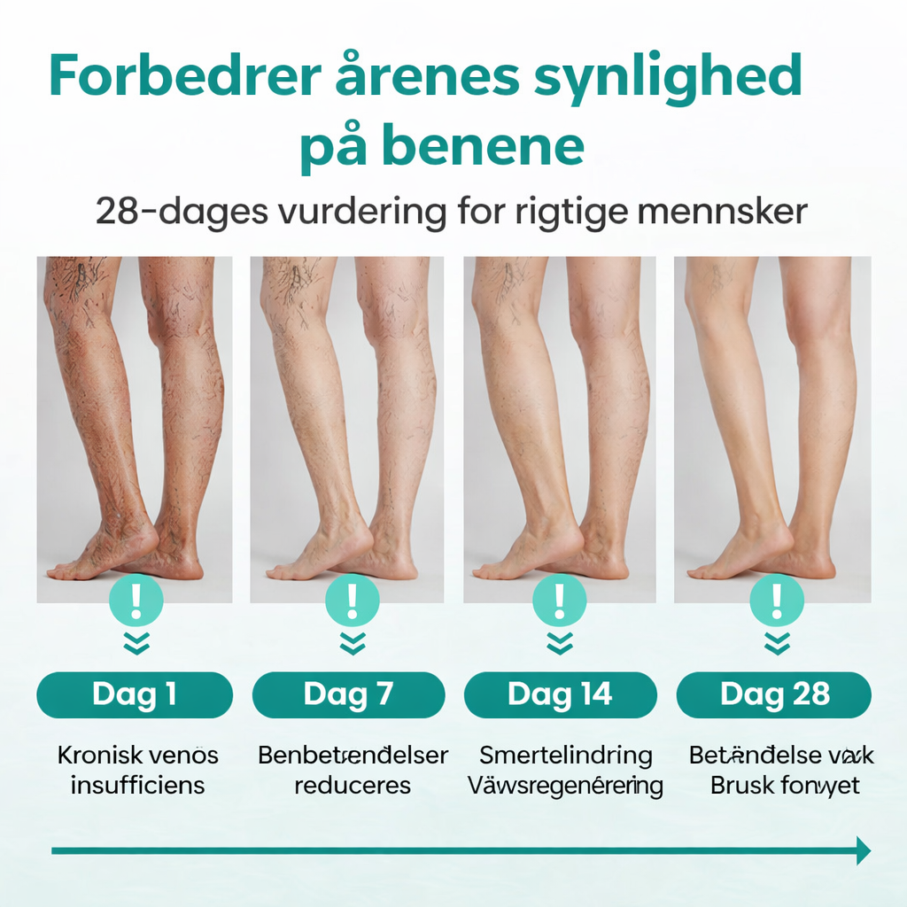 VeinHeal™ – Slip for tunge og trætte ben