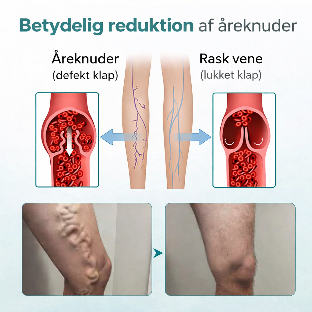 VeinHeal™ – Slip for tunge og trætte ben