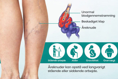 VeinHeal™ – Slip for tunge og trætte ben
